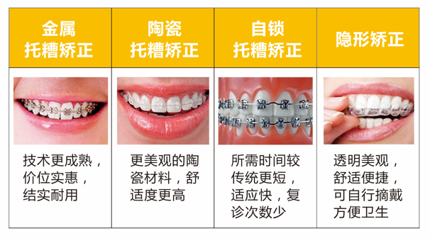 常见的牙齿矫正方式